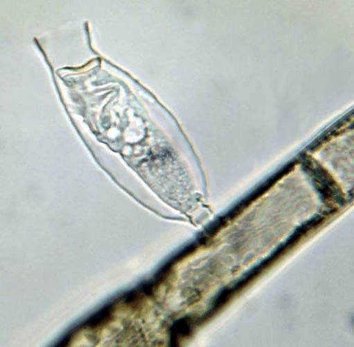 污水处理中的微观世界 常见微生物照片及作用解析